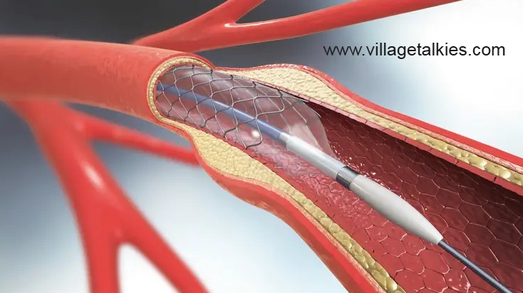 Top 5 Medical and Healthcare Video Production Companies in London, United Kingdom